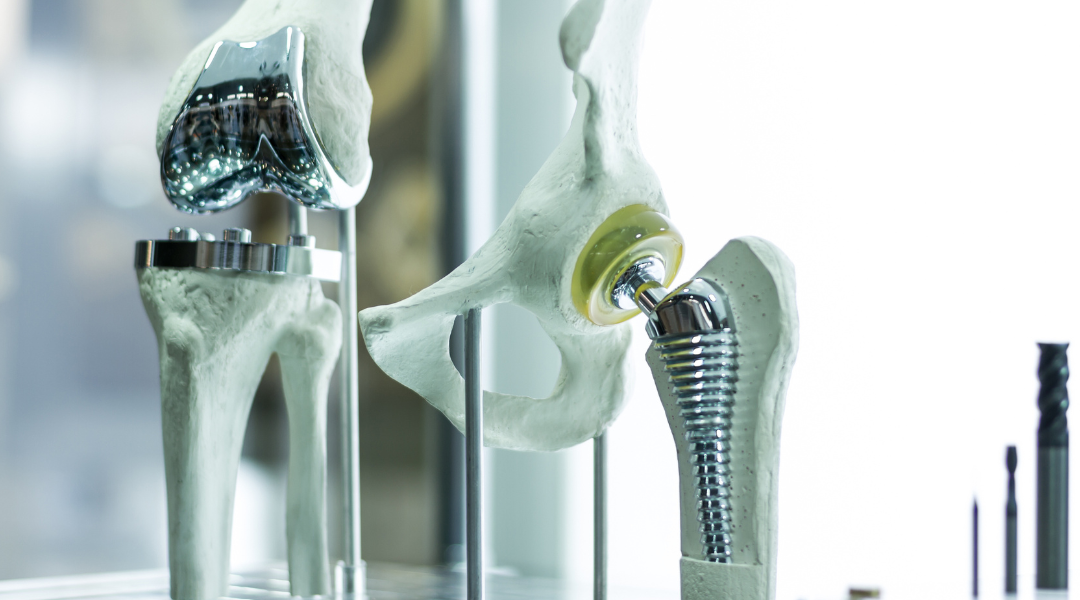 precision machining within orthopedic manufacturing created the joint replacement shown here